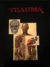 Trauma